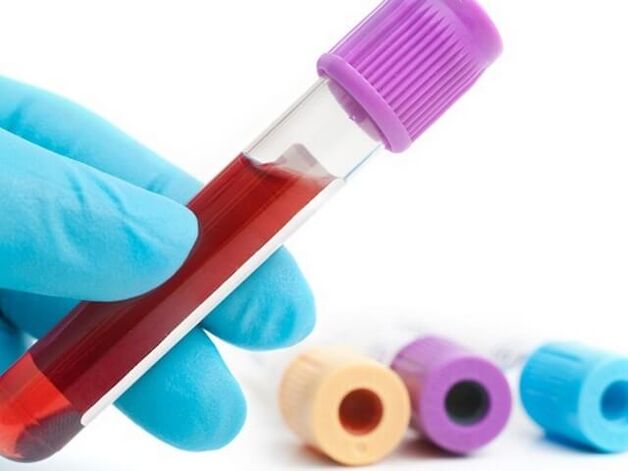 Laboratorijske metode