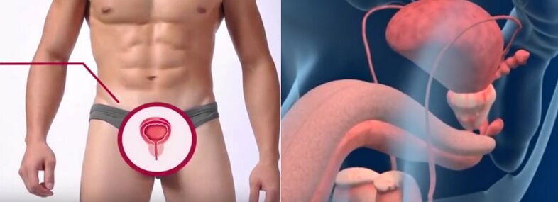 Prostatitis pri moških, prepoznaven po določenih znakih